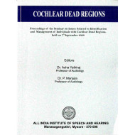 Cochlear Dead Regions